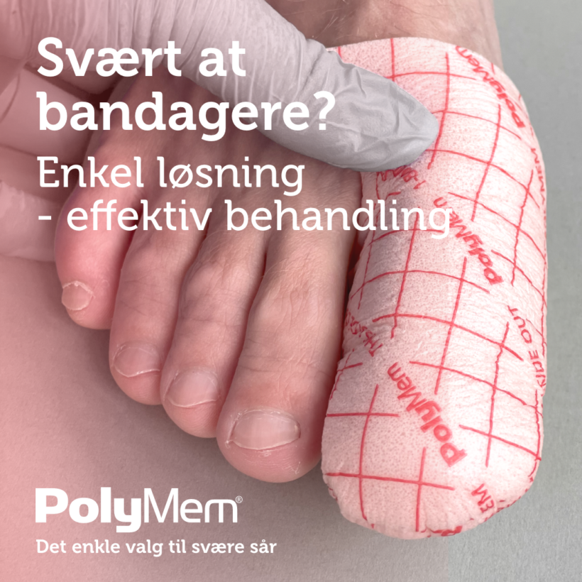 Anvendelse af bandage